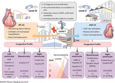 Contemporary approach to cardiogenic shock care: a state-of-the-art review